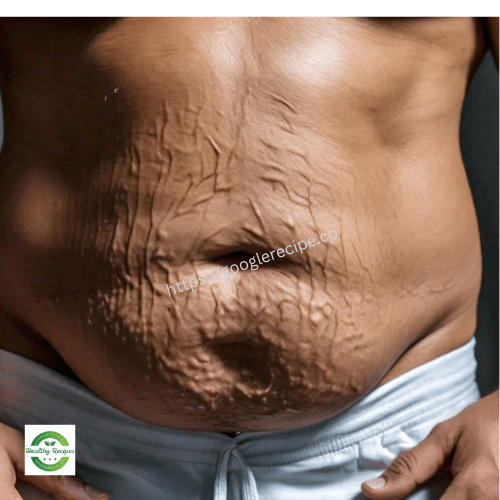 How to reduce abdominal fat?