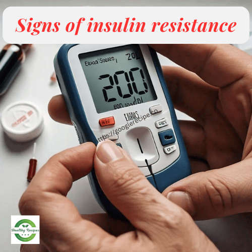 Signs of insulin resistance